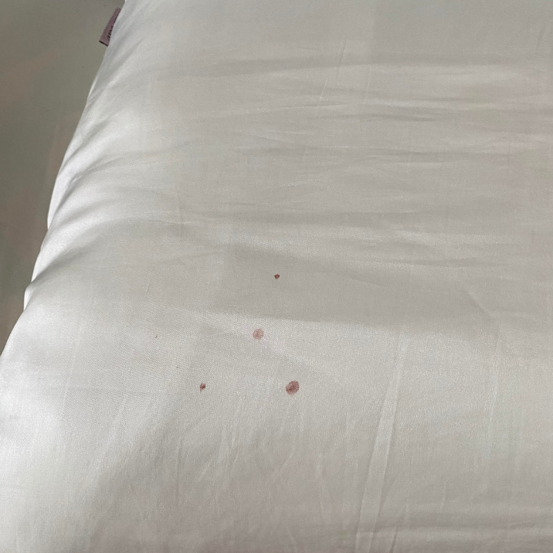 comment savoir si on a des punaises de lit